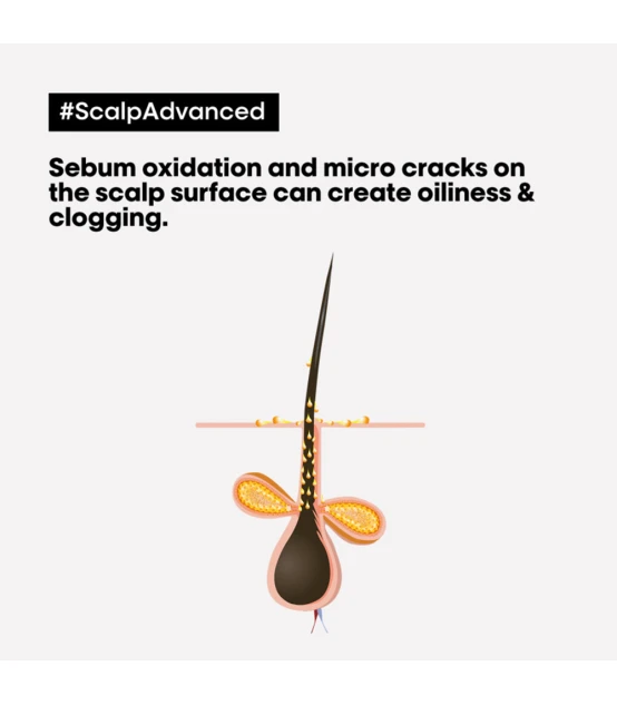 L'Oréal Professionnel Scalp Advanced Argile Professionnelle Anti-Gr...
