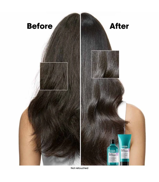 L'Oréal Professionnel Série Expert Scalp Advanced Shampooing Anti-I...