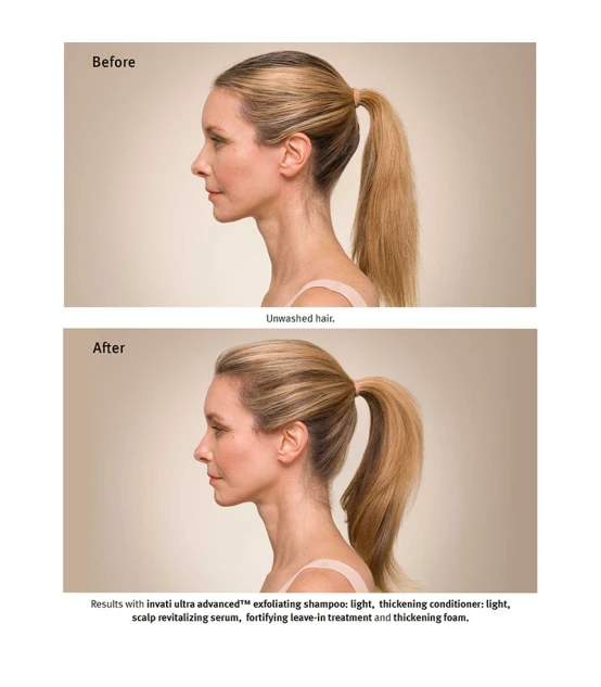 Aveda Invati Ultra Advanced Light System  | Celini.fr