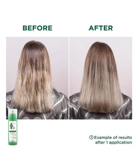 Klorane Shampooing Sec Séboréducteur à l'Ortie 150ml  | Celini.fr